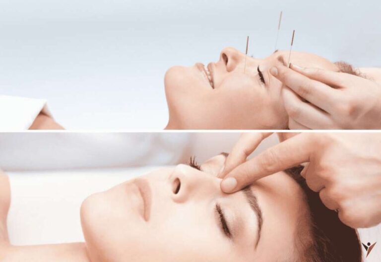 Quick Guide And Benefits Of Acupuncture and Acupressure For Human Body